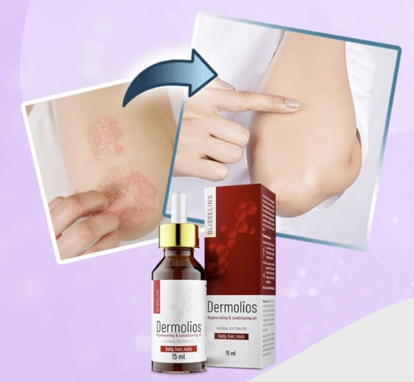 Dermolios olje Slovenija - Cena kje kupiti mnenja uporaba