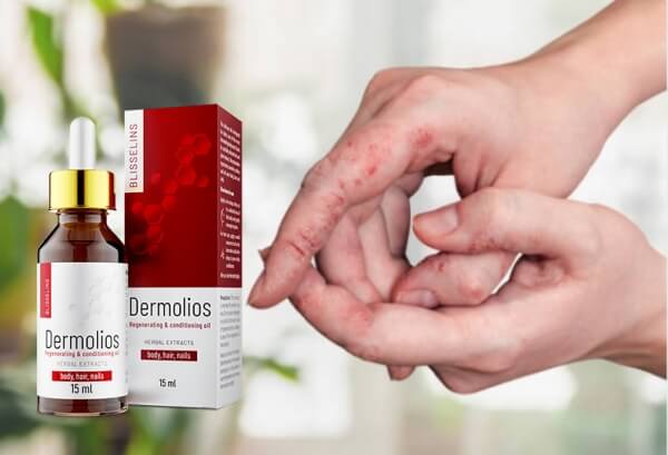 Sestava in lastnosti