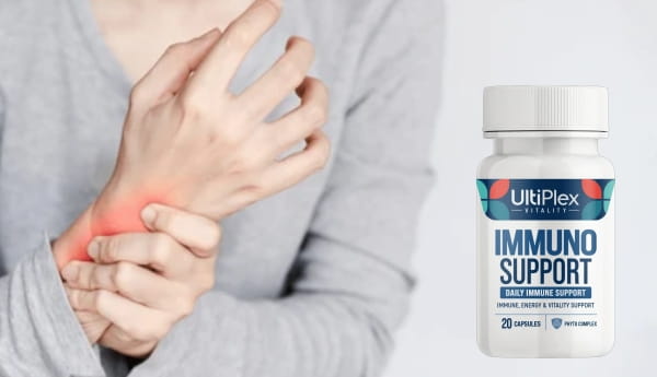 Cena UltiPlexa v Sloveniji – koliko stane